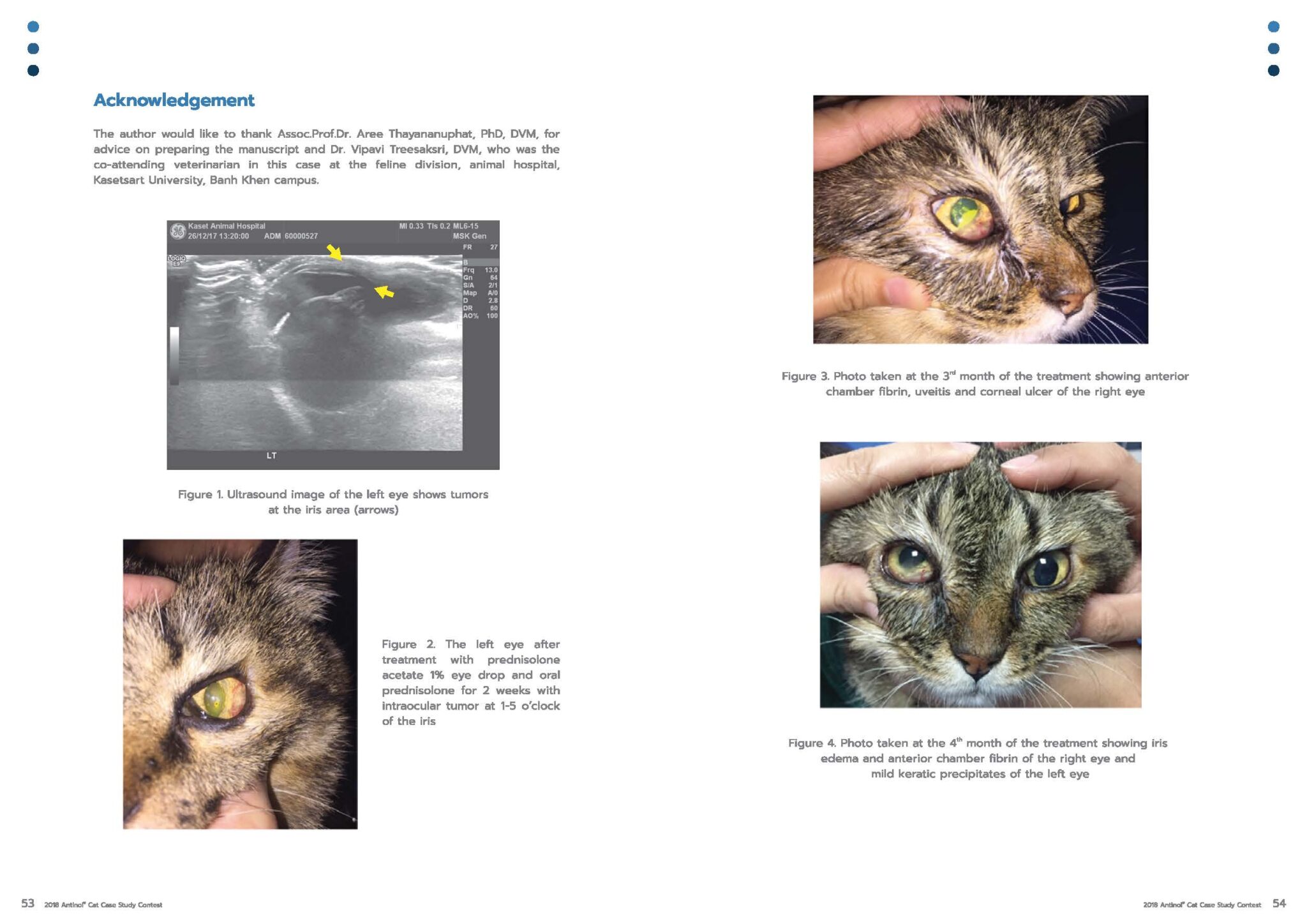 Use of PCSO524® for Control of Inflammation Caused by Iris Tumorand